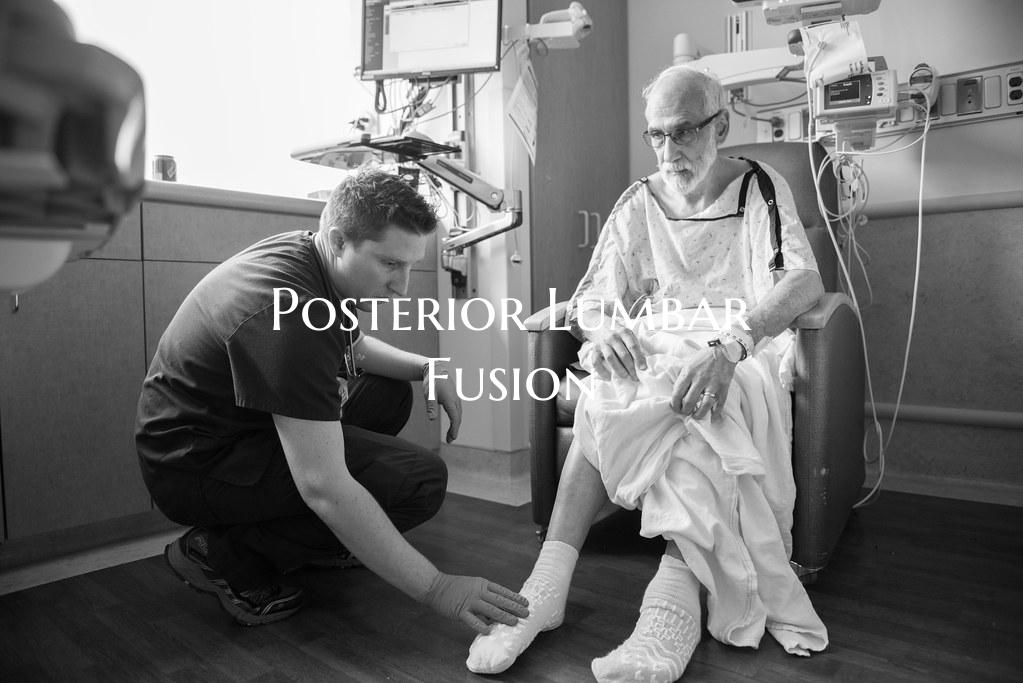Posterior Lumbar Fusion